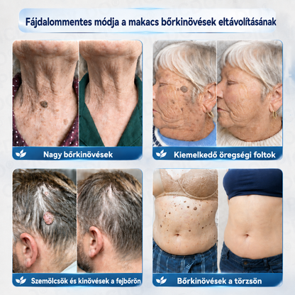 🛒𝐏𝐢𝐜𝐝𝐨® 𝟕 𝐍𝐚𝐩𝐨𝐬 𝐊𝐫é𝐦 𝐁ő𝐫𝐟ü𝐠𝐠𝐞𝐥é𝐤𝐞𝐤 é𝐬 𝐏𝐢𝐠𝐦𝐞𝐧𝐭𝐟𝐨𝐥𝐭𝐨𝐤 𝐄𝐥𝐥𝐞𝐧 (𝐅á𝐣𝐝𝐚𝐥𝐨𝐦𝐦𝐞𝐧𝐭𝐞𝐬 𝐅𝐨𝐫𝐦𝐮𝐥𝐚 – 𝐇𝐞𝐠𝐞𝐤 𝐍é𝐥𝐤ü𝐥) 🌼