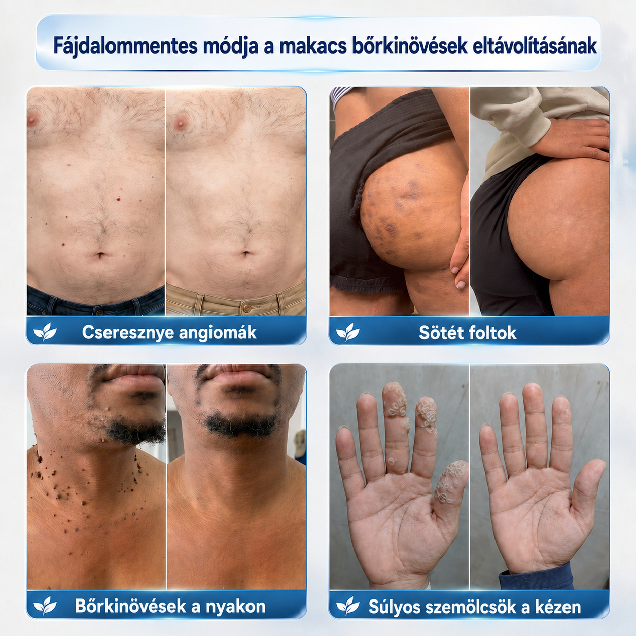 🛒𝐏𝐢𝐜𝐝𝐨® 𝟕 𝐍𝐚𝐩𝐨𝐬 𝐊𝐫é𝐦 𝐁ő𝐫𝐟ü𝐠𝐠𝐞𝐥é𝐤𝐞𝐤 é𝐬 𝐏𝐢𝐠𝐦𝐞𝐧𝐭𝐟𝐨𝐥𝐭𝐨𝐤 𝐄𝐥𝐥𝐞𝐧 (𝐅á𝐣𝐝𝐚𝐥𝐨𝐦𝐦𝐞𝐧𝐭𝐞𝐬 𝐅𝐨𝐫𝐦𝐮𝐥𝐚 – 𝐇𝐞𝐠𝐞𝐤 𝐍é𝐥𝐤ü𝐥) 🌼