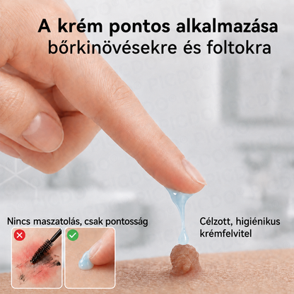 🛒𝐏𝐢𝐜𝐝𝐨® 𝟕 𝐍𝐚𝐩𝐨𝐬 𝐊𝐫é𝐦 𝐁ő𝐫𝐟ü𝐠𝐠𝐞𝐥é𝐤𝐞𝐤 é𝐬 𝐏𝐢𝐠𝐦𝐞𝐧𝐭𝐟𝐨𝐥𝐭𝐨𝐤 𝐄𝐥𝐥𝐞𝐧 (𝐅á𝐣𝐝𝐚𝐥𝐨𝐦𝐦𝐞𝐧𝐭𝐞𝐬 𝐅𝐨𝐫𝐦𝐮𝐥𝐚 – 𝐇𝐞𝐠𝐞𝐤 𝐍é𝐥𝐤ü𝐥) 🌼