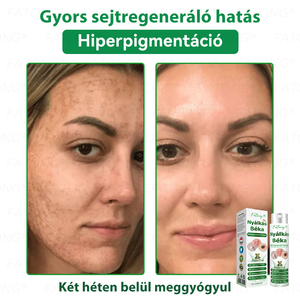 𝐹𝑎𝑡𝑜𝑛𝑔®𝘽é𝙠á𝙣𝙮á𝙡-𝙠𝙞𝙫𝙤𝙣𝙖𝙩ú 𝘽ő𝙧𝙧𝙚𝙜𝙚𝙣𝙚𝙧á𝙡ó 𝙎𝙥𝙧𝙖𝙮(Kifejezetten a bőr regenerálására, helyreállítására és nyugtatására tervezték!)🔥