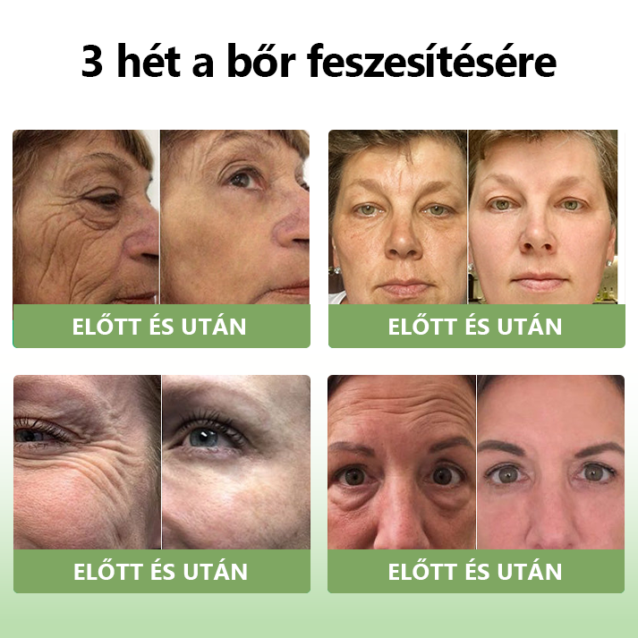 STDEI™ Luxus  kollagén  feszesítő  krém 👨‍⚕️