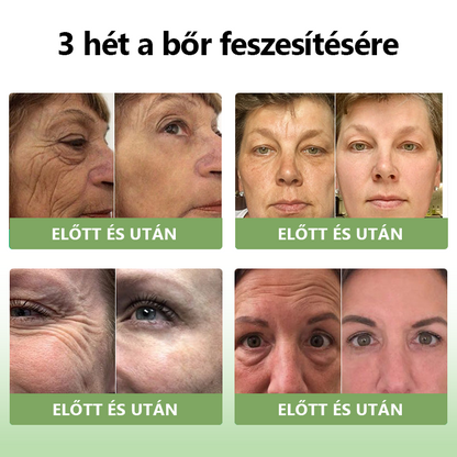 STDEI™ Luxus  kollagén  feszesítő  krém 👨‍⚕️