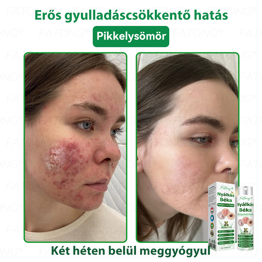 𝐹𝑎𝑡𝑜𝑛𝑔®𝘽é𝙠á𝙣𝙮á𝙡-𝙠𝙞𝙫𝙤𝙣𝙖𝙩ú 𝘽ő𝙧𝙧𝙚𝙜𝙚𝙣𝙚𝙧á𝙡ó 𝙎𝙥𝙧𝙖𝙮(Kifejezetten a bőr regenerálására, helyreállítására és nyugtatására tervezték!)🔥