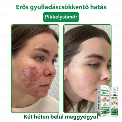 𝐹𝑎𝑡𝑜𝑛𝑔®𝘽é𝙠á𝙣𝙮á𝙡-𝙠𝙞𝙫𝙤𝙣𝙖𝙩ú 𝘽ő𝙧𝙧𝙚𝙜𝙚𝙣𝙚𝙧á𝙡ó 𝙎𝙥𝙧𝙖𝙮(Kifejezetten a bőr regenerálására, helyreállítására és nyugtatására tervezték!)🔥