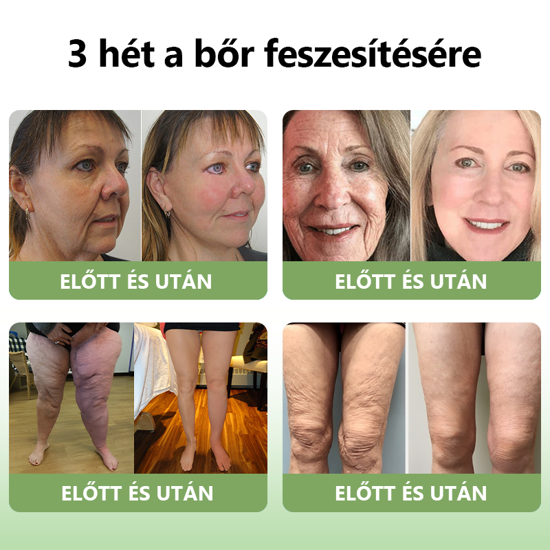 STDEI™ Luxus  kollagén  feszesítő  krém 👨‍⚕️