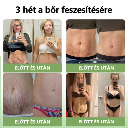 STDEI™ Luxus  kollagén  feszesítő  krém 👨‍⚕️