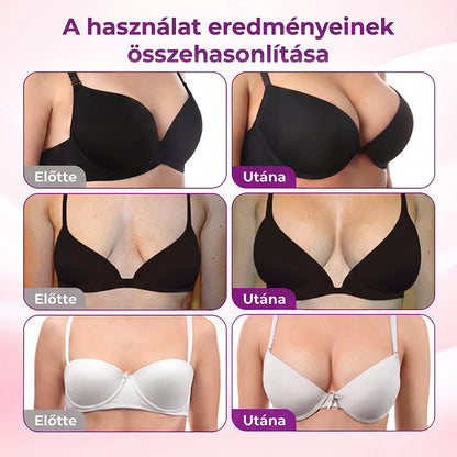 Turonu® Célzott Mellnagyobbító Fejlett Nano Mikrotűs Tapasz 🍁