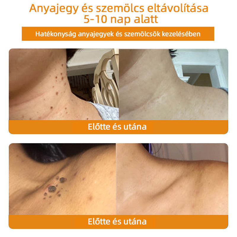 𝑇𝑢𝑟𝑜𝑛𝑢™ 𝘔é𝘩𝘱𝘦𝘮𝘱ő 𝘉ő𝘳𝘬𝘦𝘻𝘦𝘭ő 𝘒𝘳é𝘮 🐝(𝘕𝘕𝘒 𝘈𝘫á𝘯𝘭𝘰𝘵𝘵)🔥🔥