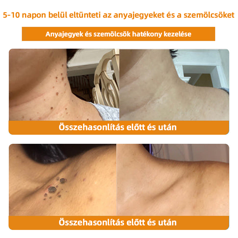 𝑇𝑢𝑟𝑜𝑛𝑢™ Méhpempő Bőrkezelő Krém (NNK Ajánlott)👨‍⚕️
