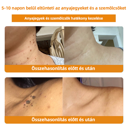 𝑇𝑢𝑟𝑜𝑛𝑢™ Méhpempő Bőrkezelő Krém (NNK Ajánlott)👨‍⚕️
