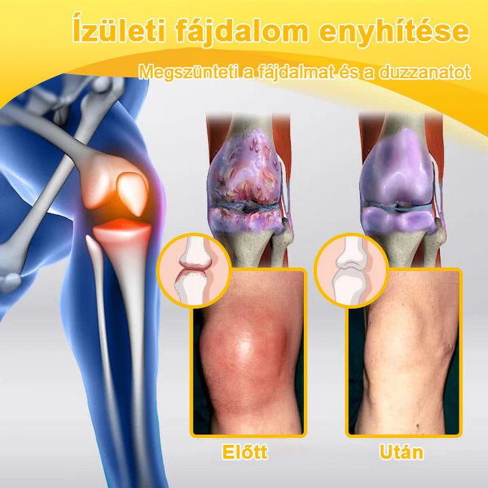 FATONG™ Méhméreg Fájdalomcsillapító Csontgyógyító Krém 🐝🐝🌿🌿 (Kifejezetten idősek számára & az AIPM ajánlja)🔥🔥