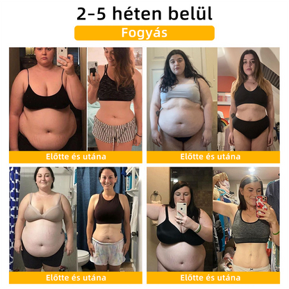 𝘾𝙕𝙏𝙄𝘾𝙇𝙀™ 𝙈𝙤𝙞𝙨𝙨𝙖𝙣𝙞𝙩 𝙢á𝙜𝙣𝙚𝙨𝙚𝙨 𝙩𝙚𝙧á𝙥𝙞á𝙨 𝙜𝙮é𝙢á𝙣𝙩 𝙜𝙮ű𝙧ű -（A gyűrű állítható, javítja a nyirokrendszert és a bőrproblémákat） 😈