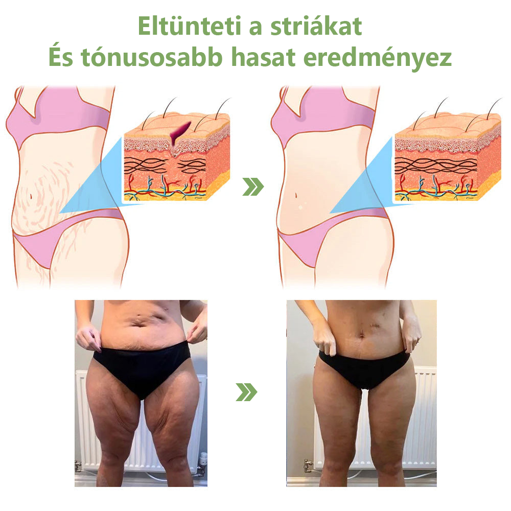 STDEI™ Luxus  kollagén  feszesítő  krém 👨‍⚕️