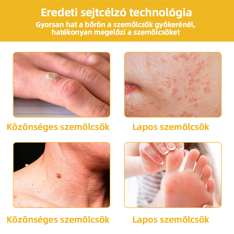𝑇𝑢𝑟𝑜𝑛𝑢™ Méhpempő Bőrkezelő Krém (NNK Ajánlott)👨‍⚕️