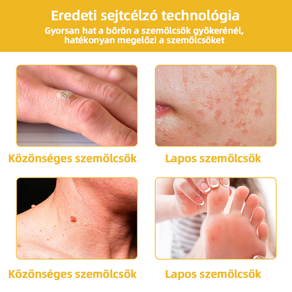 𝑇𝑢𝑟𝑜𝑛𝑢™ Méhpempő Bőrkezelő Krém (NNK Ajánlott)👨‍⚕️