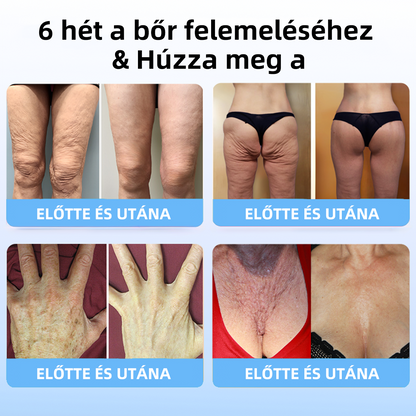 🔥🔥Utolsó nap akció: 75%-os kedvezmény🫧Fubsta® Haladó rögzítő és ránc-eltüntető krém: A bőr rugalmasságának helyreállítása-2024