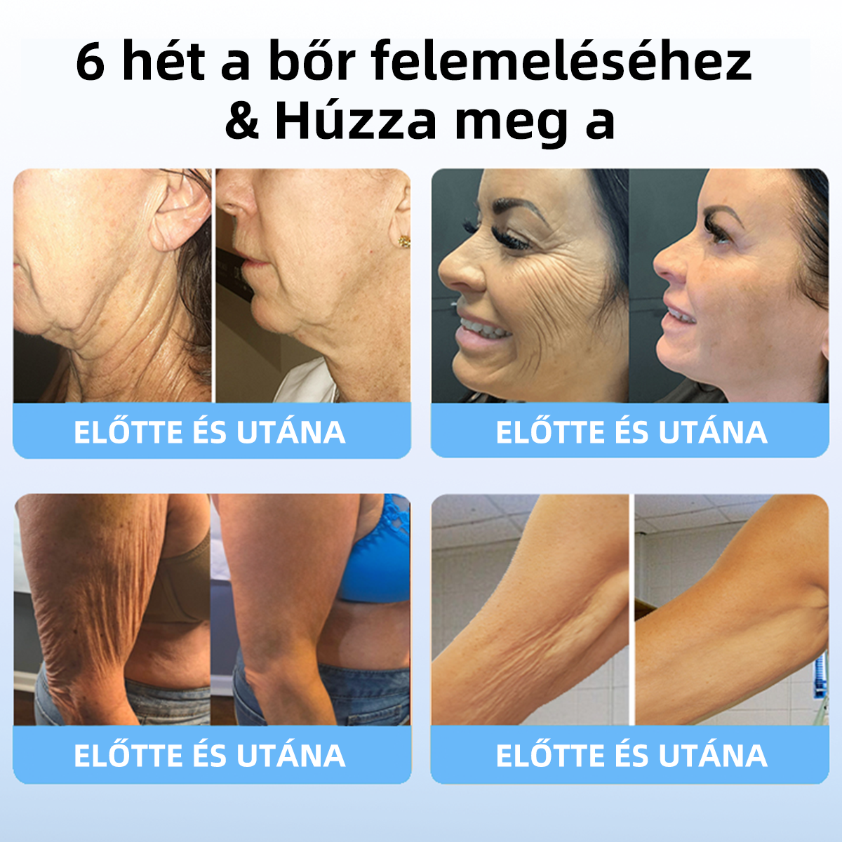 🔥🔥Utolsó nap akció: 75%-os kedvezmény🫧Fubsta® Haladó rögzítő és ránc-eltüntető krém: A bőr rugalmasságának helyreállítása-2024