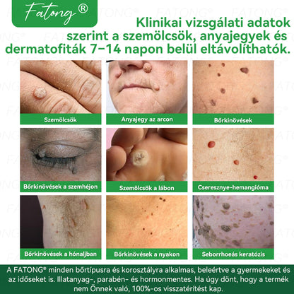 𝐹𝑎𝑡𝑜𝑛𝑔®𝘽é𝙠á𝙣𝙮á𝙡-𝙠𝙞𝙫𝙤𝙣𝙖𝙩ú 𝘽ő𝙧𝙧𝙚𝙜𝙚𝙣𝙚𝙧á𝙡ó 𝙎𝙥𝙧𝙖𝙮(Kifejezetten a bőr regenerálására, helyreállítására és nyugtatására tervezték!)🔥