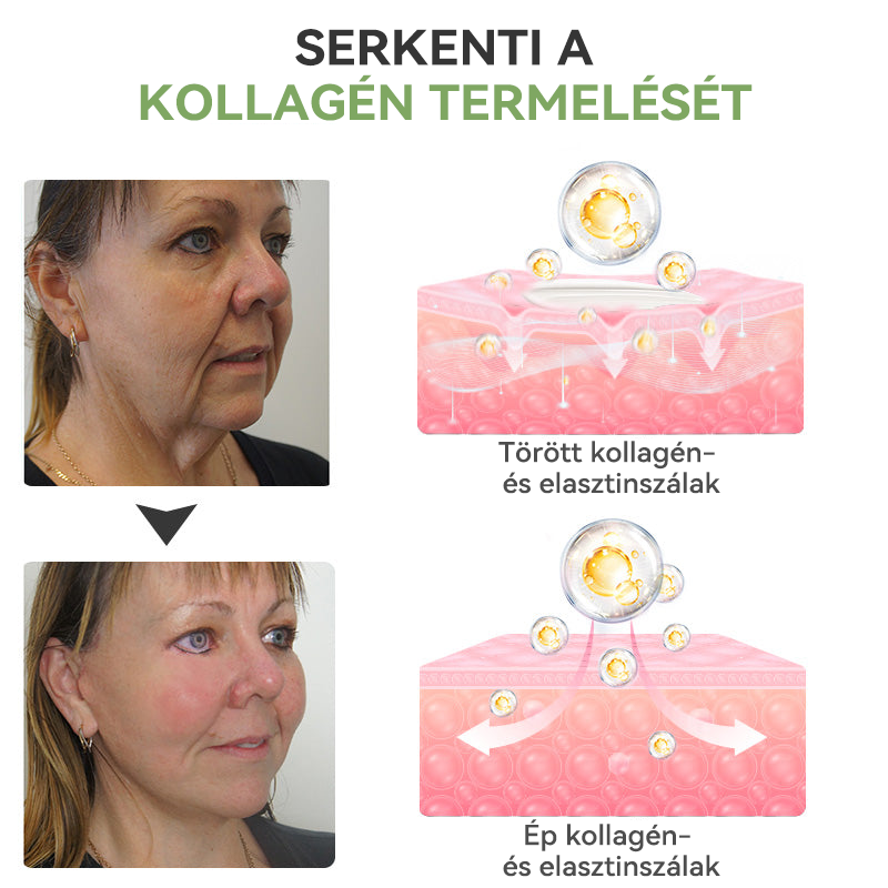STDEI™ Luxus  kollagén  feszesítő  krém 👨‍⚕️