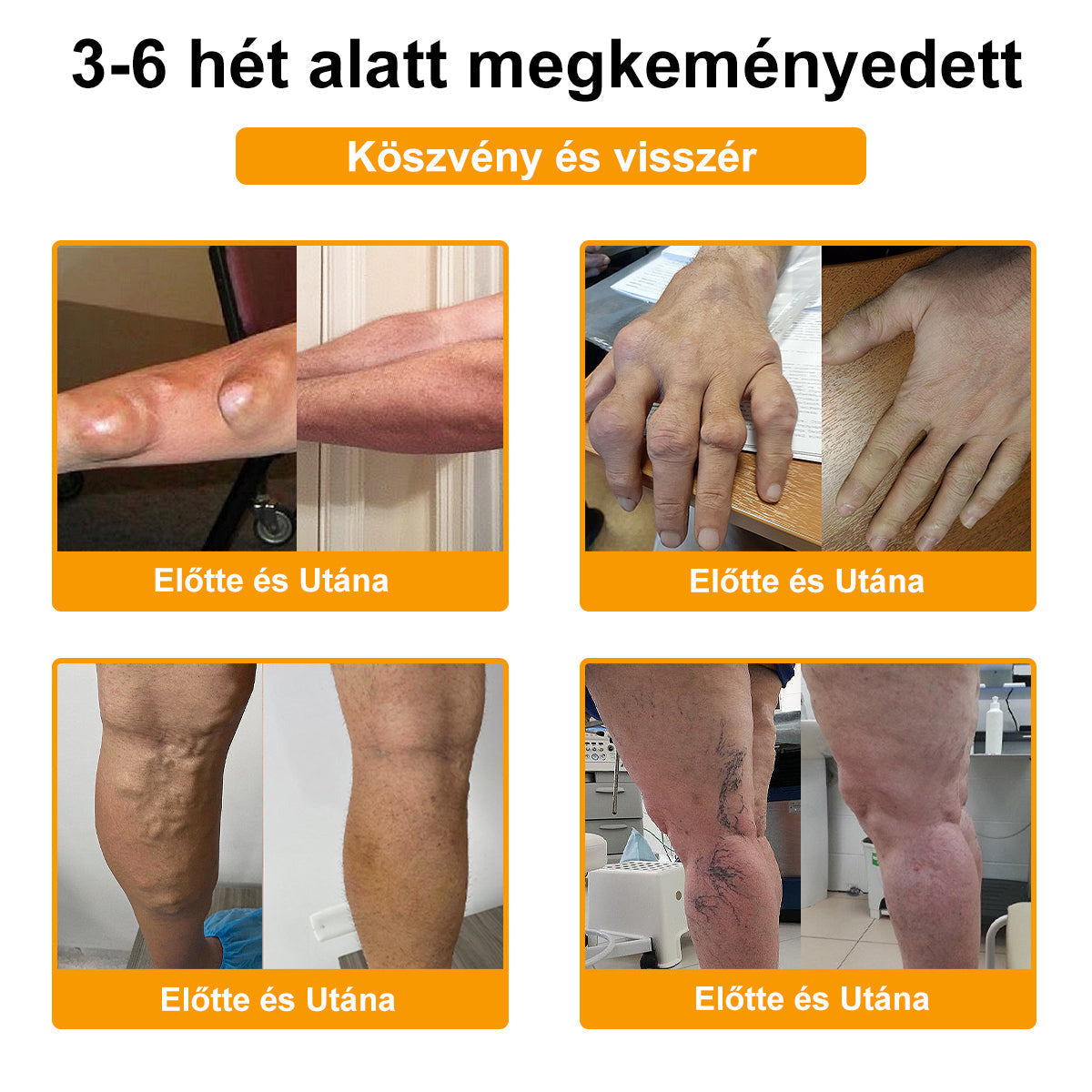 FATONG™ Méhméreg Fájdalomcsillapító Csontgyógyító Krém 🐝🐝🌿🌿 (Kifejezetten idősek számára & az AIPM ajánlja)🔥🔥
