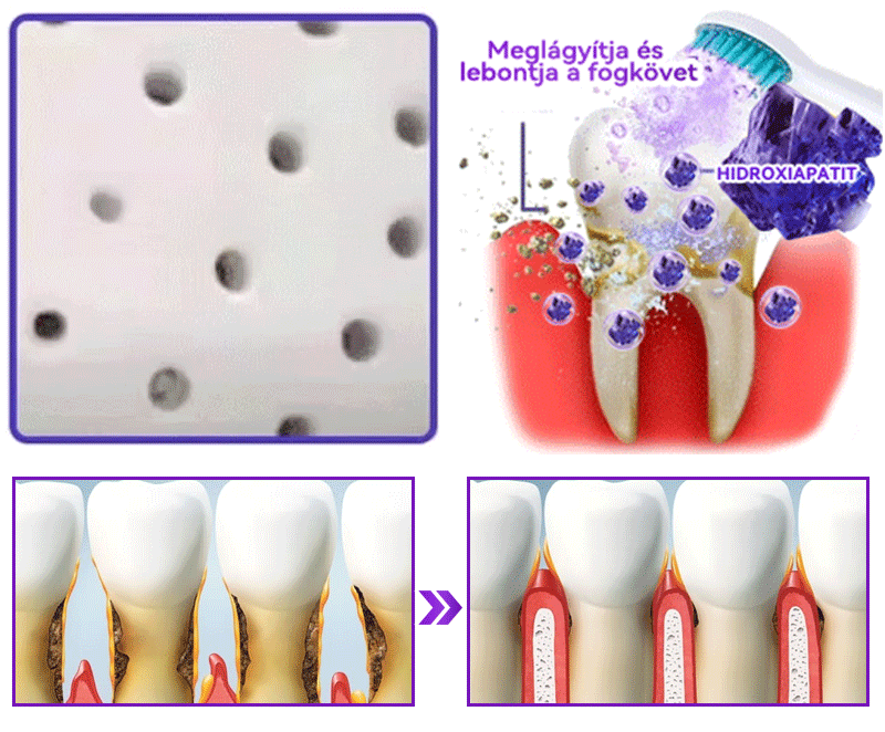 Hivatalos bolt 𝑫𝑜𝑟𝒎𝒐𝒓𝙣𝙖® Hidroxiapatit Foghelyreállitó Por👨‍⚕️Hatékonyan kezeli a szuvasodást, ínyproblémákat, érzékeny fogakat, szájüregi sebeket és sárga fogakat, miközben javítja az általános szájhigiéniát🛡️