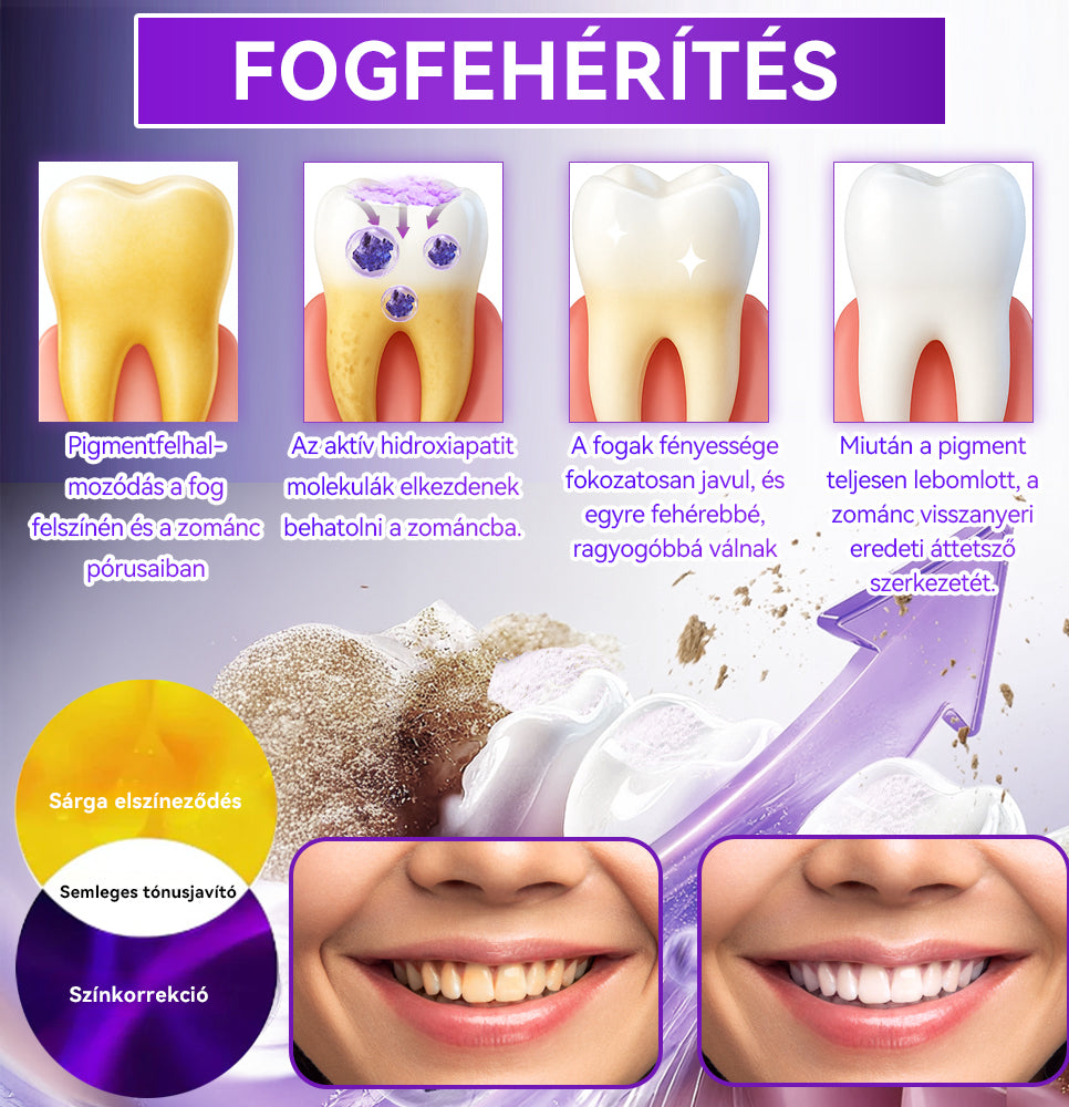 Hivatalos bolt 𝑫𝑜𝑟𝒎𝒐𝒓𝙣𝙖® Hidroxiapatit Foghelyreállitó Por👨‍⚕️Hatékonyan kezeli a szuvasodást, ínyproblémákat, érzékeny fogakat, szájüregi sebeket és sárga fogakat, miközben javítja az általános szájhigiéniát🛡️
