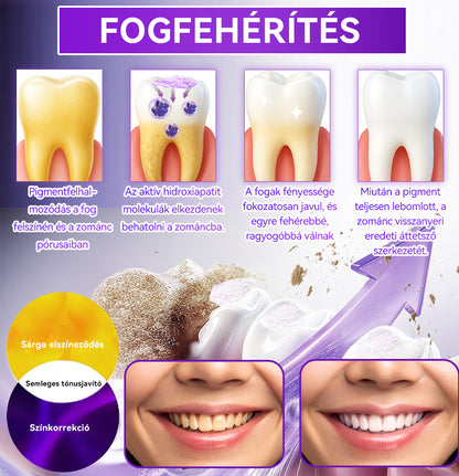 Hivatalos bolt 𝑫𝑜𝑟𝒎𝒐𝒓𝙣𝙖® Hidroxiapatit Foghelyreállitó Por👨‍⚕️Hatékonyan kezeli a szuvasodást, ínyproblémákat, érzékeny fogakat, szájüregi sebeket és sárga fogakat, miközben javítja az általános szájhigiéniát🛡️