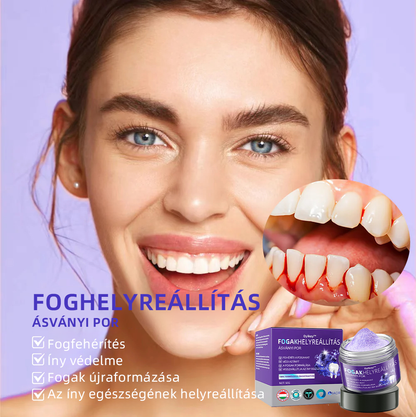 𝐎𝐲𝐢𝐤𝐞𝐲™ FOGAK HELYREÁLLÍTÁS ÁSVÁNYI POR Hatékonyan javítja a szuvasodást, ínyproblémákat, fogérzékenységet, szájfekélyeket és a fogak elszíneződését, miközben jelentősen javítja a szájüreg általános egészségét.(𝑀𝑂𝐾 𝑎𝑗á𝑛𝑙𝑜𝑡𝑡)🧑‍⚕️