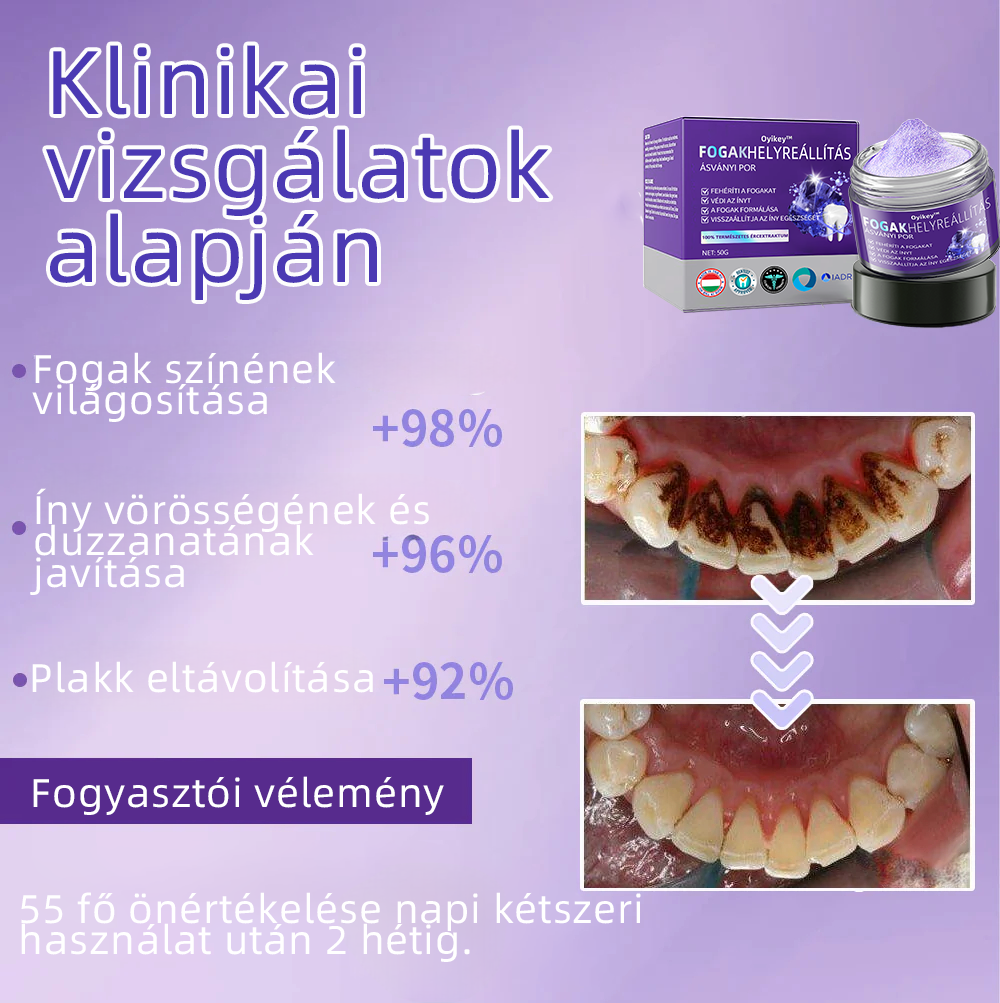 𝐎𝐲𝐢𝐤𝐞𝐲™ FOGAK HELYREÁLLÍTÁS ÁSVÁNYI POR Hatékonyan javítja a szuvasodást, ínyproblémákat, fogérzékenységet, szájfekélyeket és a fogak elszíneződését, miközben jelentősen javítja a szájüreg általános egészségét.(𝑀𝑂𝐾 𝑎𝑗á𝑛𝑙𝑜𝑡𝑡)🧑‍⚕️