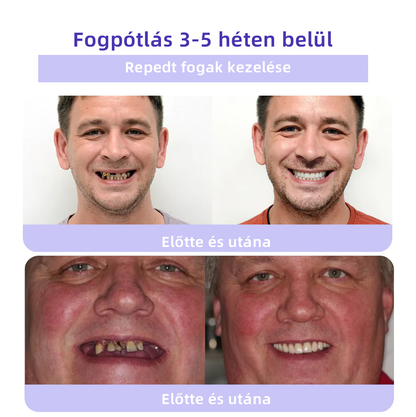 𝐎𝐲𝐢𝐤𝐞𝐲™ FOGAK HELYREÁLLÍTÁS ÁSVÁNYI POR Hatékonyan javítja a szuvasodást, ínyproblémákat, fogérzékenységet, szájfekélyeket és a fogak elszíneződését, miközben jelentősen javítja a szájüreg általános egészségét.(𝑀𝑂𝐾 𝑎𝑗á𝑛𝑙𝑜𝑡𝑡)🧑‍⚕️