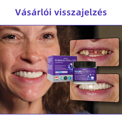 𝐎𝐲𝐢𝐤𝐞𝐲™ FOGAK HELYREÁLLÍTÁS ÁSVÁNYI POR Hatékonyan javítja a szuvasodást, ínyproblémákat, fogérzékenységet, szájfekélyeket és a fogak elszíneződését, miközben jelentősen javítja a szájüreg általános egészségét.(𝑀𝑂𝐾 𝑎𝑗á𝑛𝑙𝑜𝑡𝑡)🧑‍⚕️