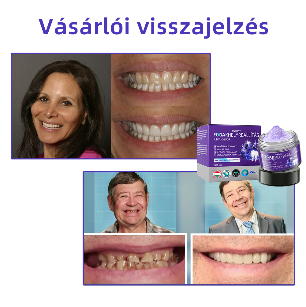 𝐎𝐲𝐢𝐤𝐞𝐲™ FOGAK HELYREÁLLÍTÁS ÁSVÁNYI POR Hatékonyan javítja a szuvasodást, ínyproblémákat, fogérzékenységet, szájfekélyeket és a fogak elszíneződését, miközben jelentősen javítja a szájüreg általános egészségét.(𝑀𝑂𝐾 𝑎𝑗á𝑛𝑙𝑜𝑡𝑡)🧑‍⚕️