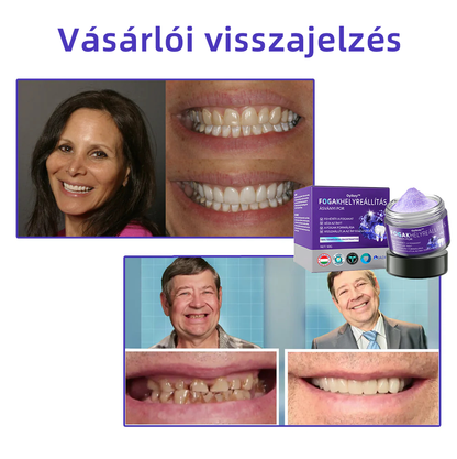 𝐎𝐲𝐢𝐤𝐞𝐲™ FOGAK HELYREÁLLÍTÁS ÁSVÁNYI POR Hatékonyan javítja a szuvasodást, ínyproblémákat, fogérzékenységet, szájfekélyeket és a fogak elszíneződését, miközben jelentősen javítja a szájüreg általános egészségét.(𝑀𝑂𝐾 𝑎𝑗á𝑛𝑙𝑜𝑡𝑡)🧑‍⚕️