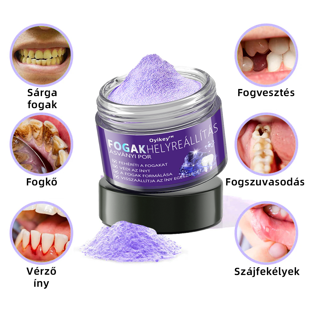 𝐎𝐲𝐢𝐤𝐞𝐲™ FOGAK HELYREÁLLÍTÁS ÁSVÁNYI POR Hatékonyan javítja a szuvasodást, ínyproblémákat, fogérzékenységet, szájfekélyeket és a fogak elszíneződését, miközben jelentősen javítja a szájüreg általános egészségét.(𝑀𝑂𝐾 𝑎𝑗á𝑛𝑙𝑜𝑡𝑡)🧑‍⚕️
