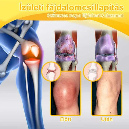 👩‍⚕️👩‍⚕️𝐀𝐞𝐞𝐡𝐟𝐞𝐧𝐠™ 𝐌é𝐡𝐦é𝐫𝐞𝐠 𝐅𝐞𝐣𝐥𝐞𝐭𝐭 𝐈𝐳𝐮𝐥𝐞𝐭𝐢 é𝐬 𝐂𝐬𝐨𝐧𝐭𝐭𝐞𝐫𝐚𝐩𝐢𝐚𝐬 𝐊𝐫é𝐦 (𝐔𝐣-𝐙é𝐥𝐚𝐧𝐝𝐢 𝐌é𝐡𝐤𝐢𝐯𝐨𝐧𝐚𝐭 - 𝐒𝐩𝐞𝐜𝐢𝐚𝐥𝐢𝐳á𝐥𝐨𝐝𝐢𝐤 𝐎𝐫𝐭𝐨𝐩é𝐝𝐢𝐚𝐢 𝐁𝐞𝐭𝐞𝐠𝐬é𝐠𝐞𝐤𝐫𝐞 é𝐬 𝐈𝐳𝐮𝐥𝐞𝐭𝐢 𝐆𝐲𝐮𝐥𝐥𝐚𝐝