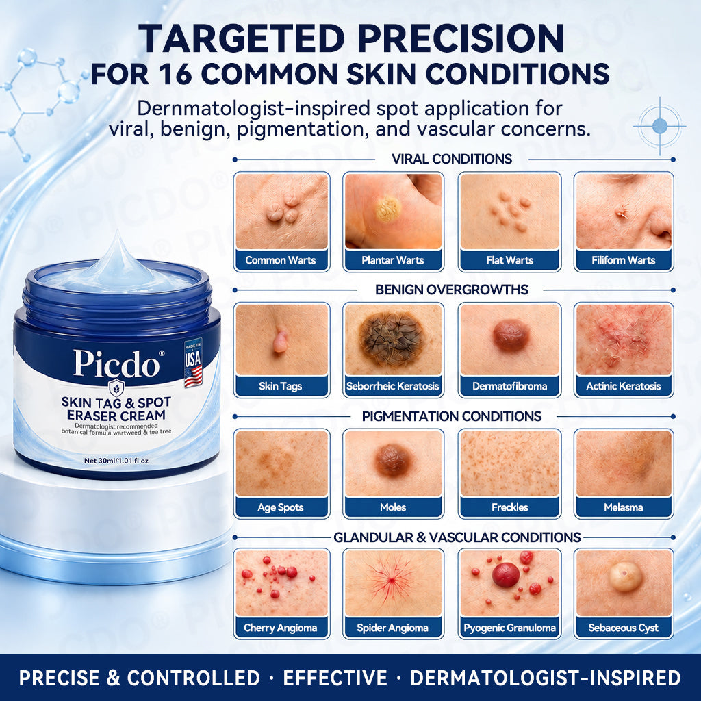 ✨🛒𝐏𝐢𝐜𝐝𝐨® 7-𝐃𝐚𝐲 𝐒𝐤𝐢𝐧 𝐓𝐚𝐠 & 𝐒𝐩𝐨𝐭 𝐄𝐫𝐚𝐬𝐞𝐫 𝐂𝐫𝐞𝐚𝐦🩵 (Zero Pain, Zero 𝐒𝐜𝐚𝐫𝐬 Formula)