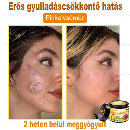 𝐀𝐏𝐊𝐀𝐏𝐊® 𝐌é𝐡𝐦é𝐫𝐞𝐠 Á𝐭𝐟𝐨𝐠ó 𝐤𝐫é𝐦 (🐝𝐬𝐞𝐠í𝐭 𝐦𝐞𝐠𝐨𝐥𝐝𝐚𝐧𝐢 𝐚𝐳 𝐚𝐥á𝐛𝐛𝐢 𝐛ő𝐫𝐩𝐫𝐨𝐛𝐥é𝐦á𝐤𝐚𝐭: 𝐫á𝐧𝐜𝐨𝐤, 𝐡𝐞𝐠𝐞𝐤, 𝐩𝐢𝐠𝐦𝐞𝐧𝐭𝐟𝐨𝐥𝐭𝐨𝐤, 𝐬𝐭𝐫𝐢á𝐤, 𝐩𝐚𝐭𝐭𝐚𝐧á𝐬𝐨𝐤, 𝐩𝐢𝐤𝐤𝐞𝐥𝐲𝐬ö𝐦ö𝐫, 𝐞𝐤𝐜é𝐦𝐚, 𝐛ő𝐫𝐞𝐥𝐯á𝐥𝐭𝐨𝐳á𝐬𝐨𝐤, 𝐢𝐫𝐫𝐢𝐭á𝐜𝐢ó𝐤, 𝐠𝐲𝐮𝐥𝐥𝐚𝐝á𝐬𝐨𝐤 é𝐬 𝐞𝐠𝐲é𝐛 𝐛ő𝐫𝐩𝐚𝐧𝐚𝐬𝐳𝐨𝐤)🔥