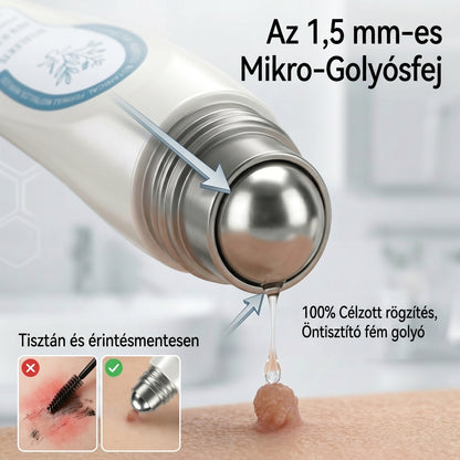 Hivatalos márkabolt | ✅👩‍⚕️ 𝐏i𝐜𝐝o® 7-Napos 𝗧𝗮𝗴 & 𝗦𝗽𝗼𝘁 𝐄𝐫𝐚𝘀𝐞𝐫 (Fájdalommentes, heg nélküli – golyós applikátor) 🎉