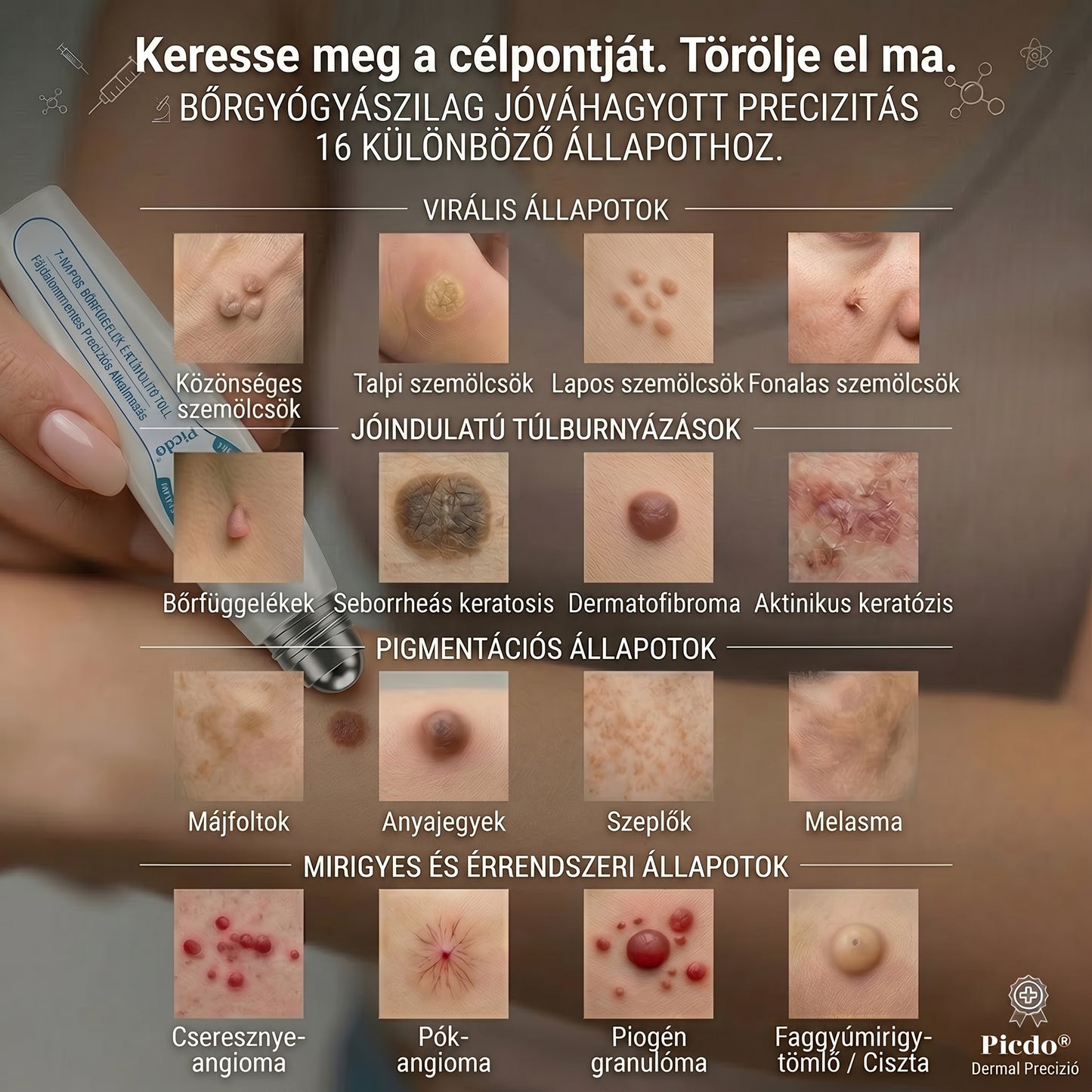 Hivatalos márkabolt | ✅👩‍⚕️ 𝐏i𝐜𝐝o® 7-Napos 𝗧𝗮𝗴 & 𝗦𝗽𝗼𝘁 𝐄𝐫𝐚𝘀𝐞𝐫 (Fájdalommentes, heg nélküli – golyós applikátor) 🎉