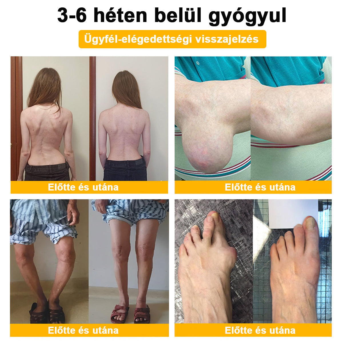 FATONG™ Méhméreg Fájdalomcsillapító Csontgyógyító Krém 🐝🐝🌿🌿 (Kifejezetten idősek számára & az AIPM ajánlja)🔥🔥