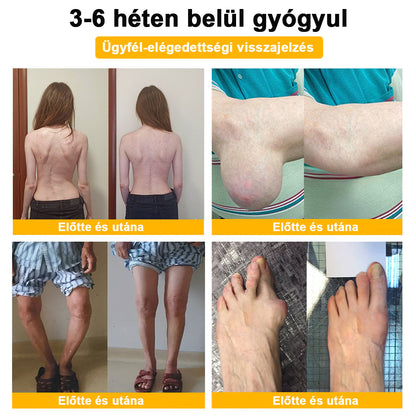 FATONG™ Méhméreg Fájdalomcsillapító Csontgyógyító Krém 🐝🐝🌿🌿 (Kifejezetten idősek számára & az AIPM ajánlja)🔥🔥