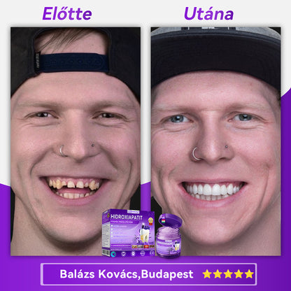 Hivatalos bolt 𝑫𝑜𝑟𝒎𝒐𝒓𝙣𝙖® Hidroxiapatit Foghelyreállitó Por👨‍⚕️Hatékonyan kezeli a szuvasodást, ínyproblémákat, érzékeny fogakat, szájüregi sebeket és sárga fogakat, miközben javítja az általános szájhigiéniát🛡️