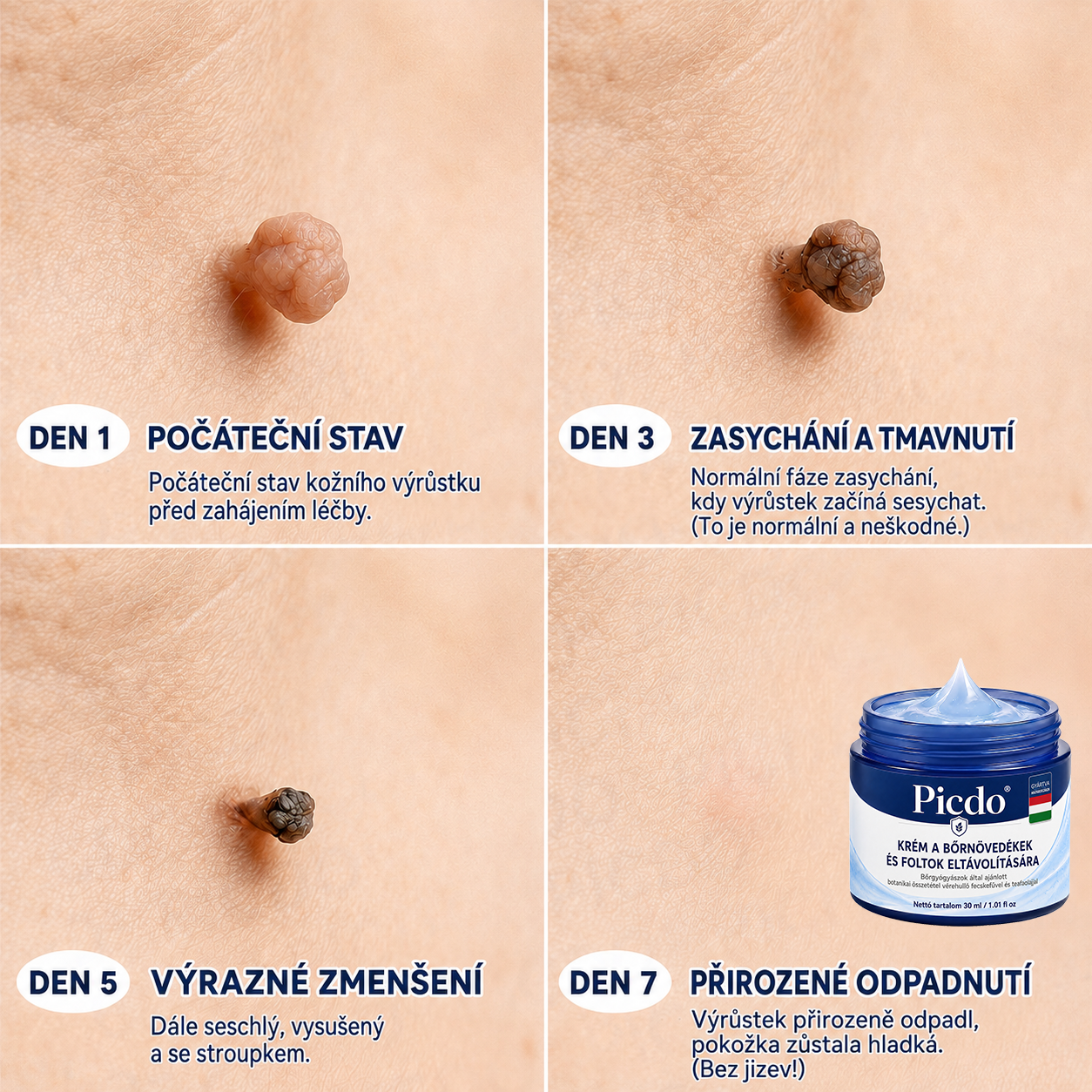 🛒𝐏𝐢𝐜𝐝𝐨® 𝟕 𝐍𝐚𝐩𝐨𝐬 𝐊𝐫é𝐦 𝐁ő𝐫𝐟ü𝐠𝐠𝐞𝐥é𝐤𝐞𝐤 é𝐬 𝐏𝐢𝐠𝐦𝐞𝐧𝐭𝐟𝐨𝐥𝐭𝐨𝐤 𝐄𝐥𝐥𝐞𝐧 (𝐅á𝐣𝐝𝐚𝐥𝐨𝐦𝐦𝐞𝐧𝐭𝐞𝐬 𝐅𝐨𝐫𝐦𝐮𝐥𝐚 – 𝐇𝐞𝐠𝐞𝐤 𝐍é𝐥𝐤ü𝐥) 🌼
