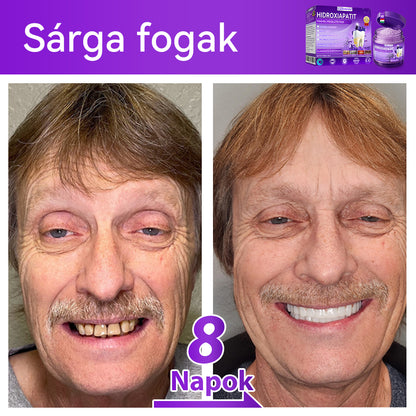 Hivatalos bolt 𝑫𝑜𝑟𝒎𝒐𝒓𝙣𝙖® Hidroxiapatit Foghelyreállitó Por👨‍⚕️Hatékonyan kezeli a szuvasodást, ínyproblémákat, érzékeny fogakat, szájüregi sebeket és sárga fogakat, miközben javítja az általános szájhigiéniát🛡️