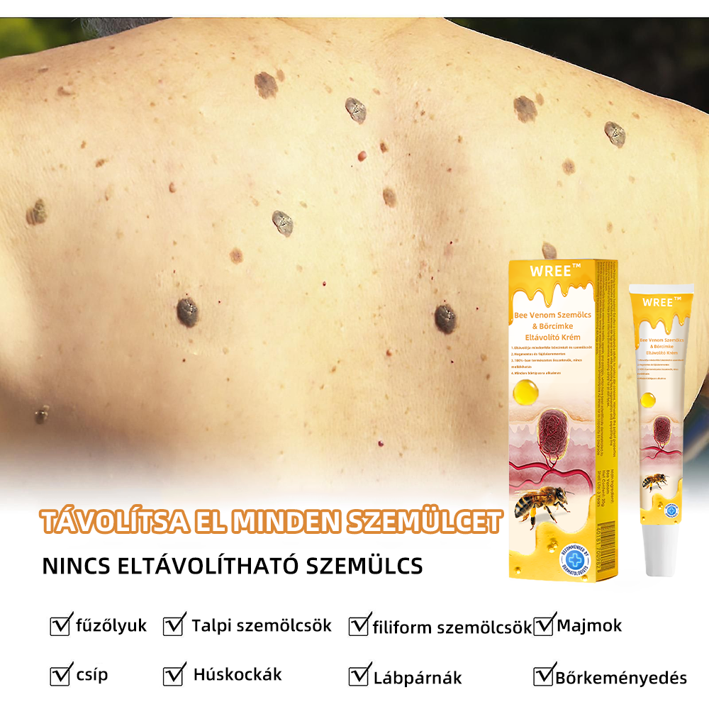 🍒🍒𝑾𝑹𝑬𝑬™ 𝑴é𝒉𝒎é𝒓𝒆𝒈 𝑺𝒛𝒆𝒎ö𝒍𝒄𝒔- é𝒔 𝑨𝒏𝒚𝒂𝒋𝒆𝒈𝒚𝒆𝒍𝒕á𝒗𝒐𝒍í𝒕ó 𝑲𝒓é𝒎(👨‍⚕𝑴𝒊𝒏𝒅𝒆𝒏 𝒃ő𝒓𝒕í𝒑𝒖𝒔𝒓𝒂 𝒂𝒍𝒌𝒂𝒍𝒎𝒂𝒔)🐝(🔥𝑼𝒕𝒐𝒍𝒔ó 𝒏𝒂𝒑𝒊 𝒂𝒌𝒄𝒊ó 60% 𝒌𝒆𝒅𝒗𝒆𝒛𝒎é𝒏𝒚)