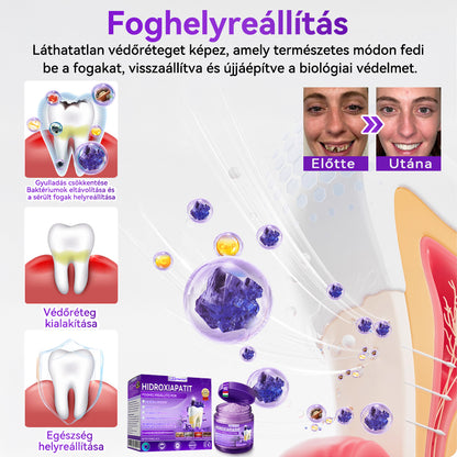 Hivatalos bolt 𝑫𝑜𝑟𝒎𝒐𝒓𝙣𝙖® Hidroxiapatit Foghelyreállitó Por👨‍⚕️Hatékonyan kezeli a szuvasodást, ínyproblémákat, érzékeny fogakat, szájüregi sebeket és sárga fogakat, miközben javítja az általános szájhigiéniát🛡️