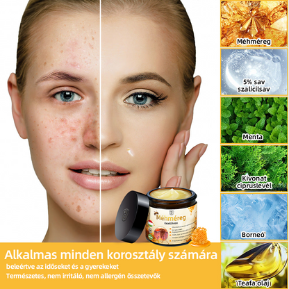 𝑇𝑢𝑟𝑜𝑛𝑢™ Méhpempő Bőrkezelő Krém (NNK Ajánlott)👨‍⚕️