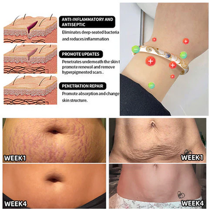 CZTICLE™ Kloisonné Enamel 👩‍⚕️ Lymphatikus mágneses terápia Arany karkötő🌺