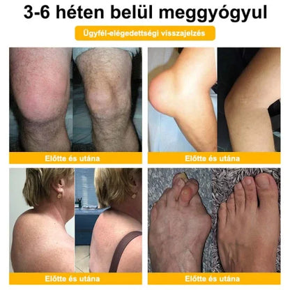 👩‍⚕️👩‍⚕️𝐀𝐞𝐞𝐡𝐟𝐞𝐧𝐠™ 𝐌é𝐡𝐦é𝐫𝐞𝐠 𝐅𝐞𝐣𝐥𝐞𝐭𝐭 𝐈𝐳𝐮𝐥𝐞𝐭𝐢 é𝐬 𝐂𝐬𝐨𝐧𝐭𝐭𝐞𝐫𝐚𝐩𝐢𝐚𝐬 𝐊𝐫é𝐦 (𝐔𝐣-𝐙é𝐥𝐚𝐧𝐝𝐢 𝐌é𝐡𝐤𝐢𝐯𝐨𝐧𝐚𝐭 - 𝐒𝐩𝐞𝐜𝐢𝐚𝐥𝐢𝐳á𝐥𝐨𝐝𝐢𝐤 𝐎𝐫𝐭𝐨𝐩é𝐝𝐢𝐚𝐢 𝐁𝐞𝐭𝐞𝐠𝐬é𝐠𝐞𝐤𝐫𝐞 é𝐬 𝐈𝐳𝐮𝐥𝐞𝐭𝐢 𝐆𝐲𝐮𝐥𝐥𝐚𝐝