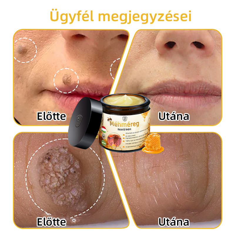 𝑇𝑢𝑟𝑜𝑛𝑢™ Méhpempő Bőrkezelő Krém (NNK Ajánlott)👨‍⚕️